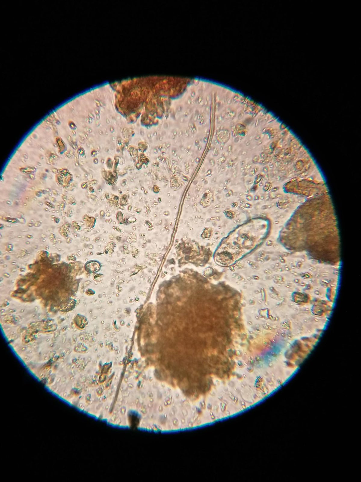 Pilzhyphe und Protozoon im Komposttee unter dem Mikroskop